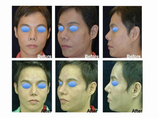 Temple lift in Thailand