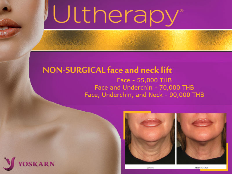 Ultherapy Thailand
